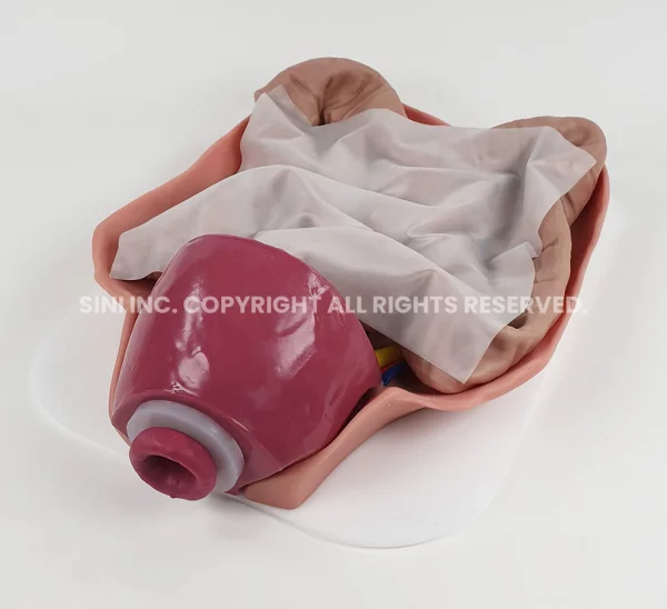 Abdominal Colon Plate (Intuitive Only)