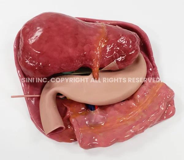 Abdominal Plate Trainer (Intuitive Only)