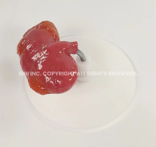 Partial Nephrectomy Trainer