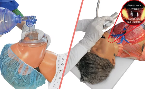 Airway Management Products Overview